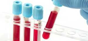 Анализ крови на скрытый сахар