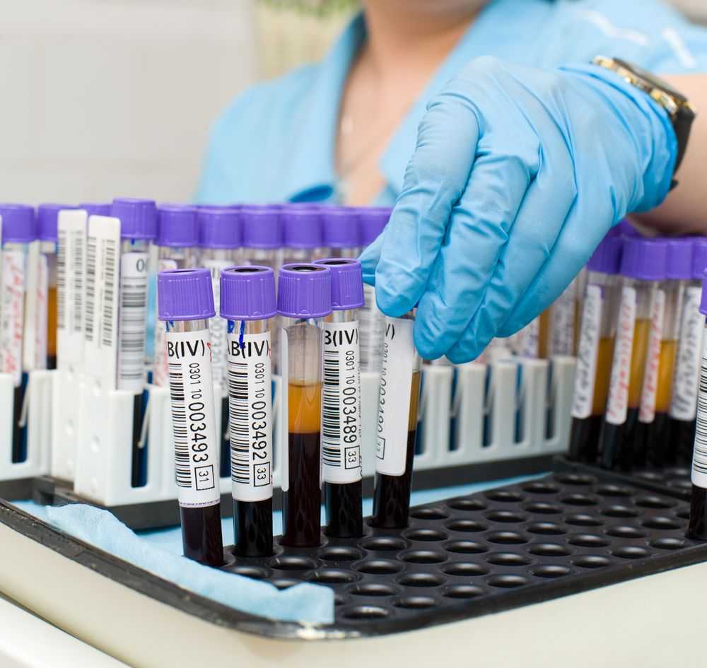 анализ биохимии крови