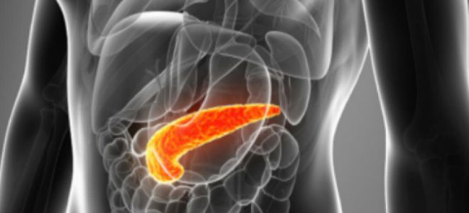 Классификация видов и форм острого панкреатита