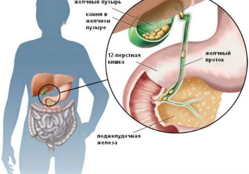 камни: анатомические особенности организма