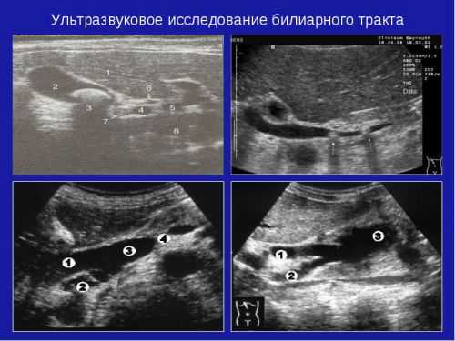 УЗИ поджелудочной железы