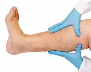 Болят ноги при сахарном диабете