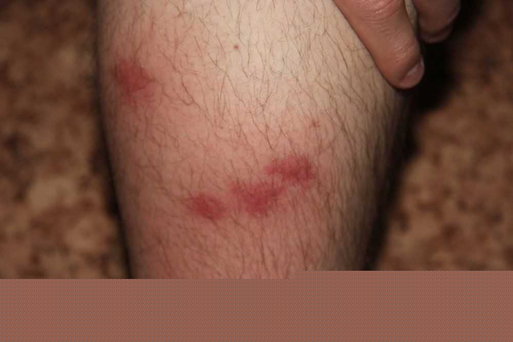 Причины возникновения болей в ногах