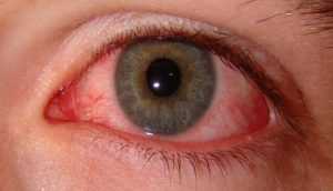 Влияние диабета на зрение