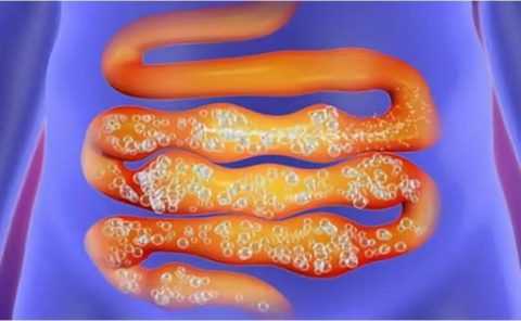 Большое количество арбузов может стать причиной повышенного газообразования. Большое количество арбузов может стать причиной повышенного газообразования.