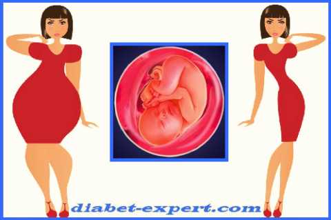 Чрезмерная худоба или лишний вес – факторы риска развития гестационного диабета Чрезмерная худоба или лишний вес – факторы риска развития гестационного диабета