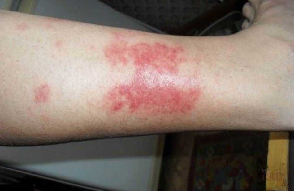 Причины развития