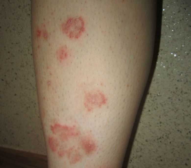 Медикаменты