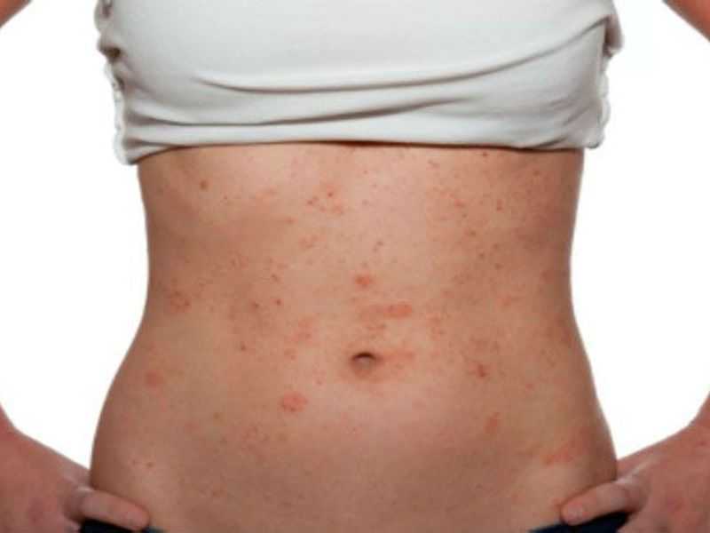 Народные рецепты