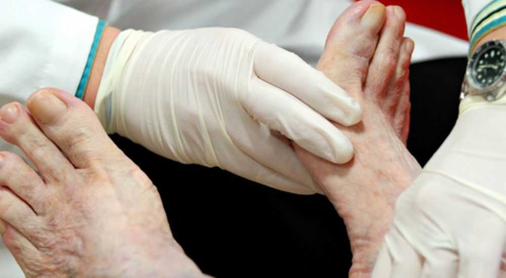 Осложнения при запущении