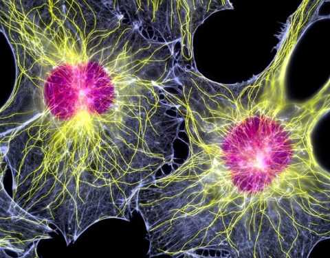 Диабетическая энцефалопатия