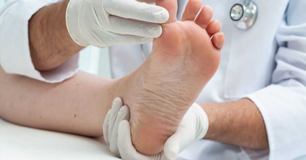 Трофические язвы