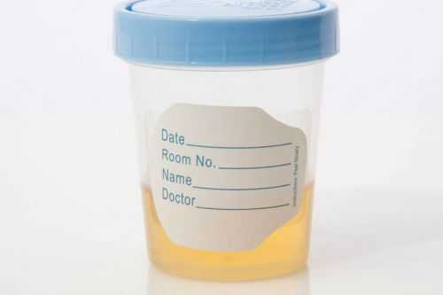 Моча для анализа