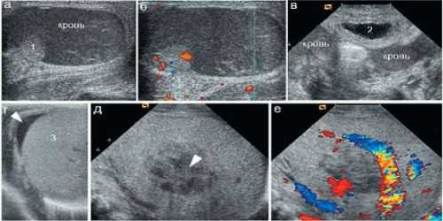 УЗИ поджелудочной железы