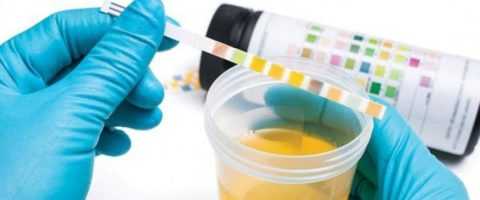 Для уточнения диагноза проводится развернутый суточный тест Для уточнения диагноза проводится развернутый суточный тест