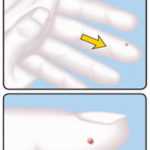 Дождитесь появления капельки крови