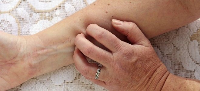 Изменения кожных покровов при панкреатите