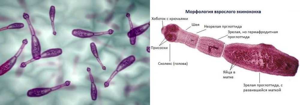 Эхинококк морфология и проекция в микроскопе