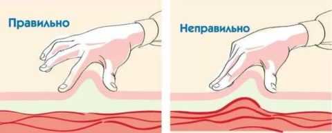 Формирование складки не должно причинять дискомфорт и физическую боль.