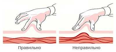 Формирование складки