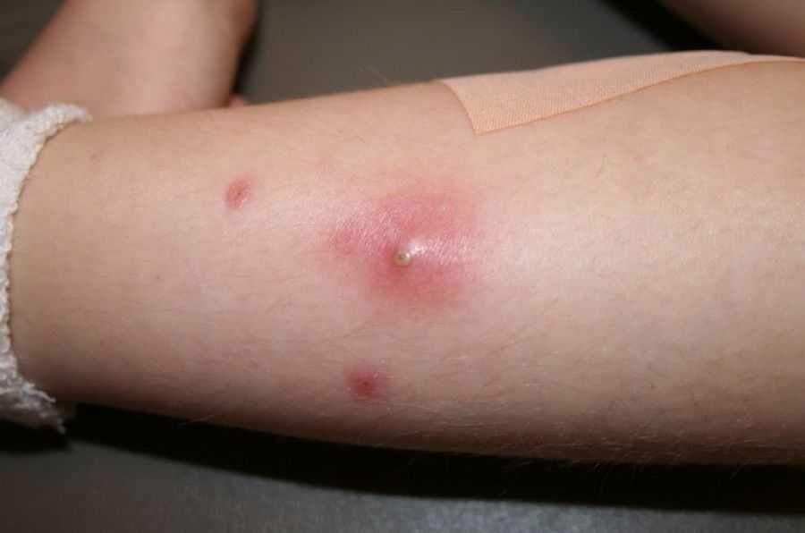 Возможные осложнения