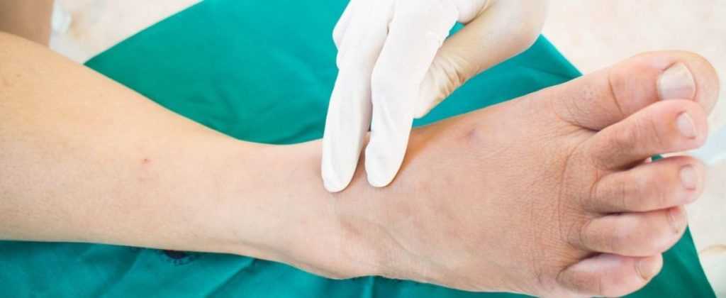 Осложнения