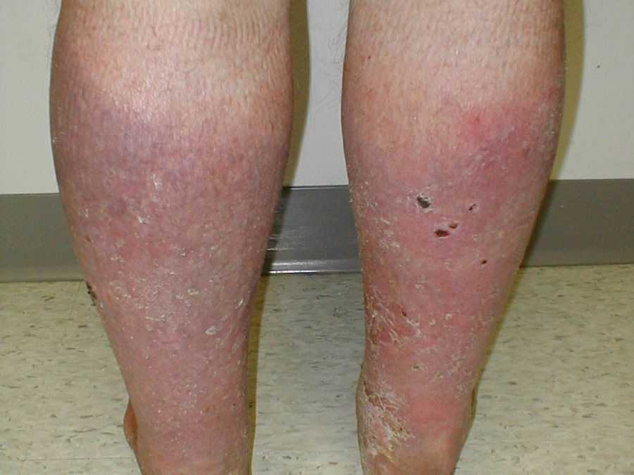 Классификация