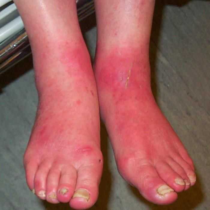 Классификация