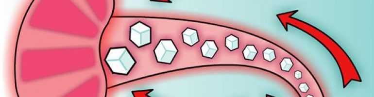 Проверка глюкозы