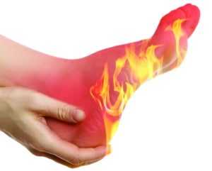 горят ноги при диабете