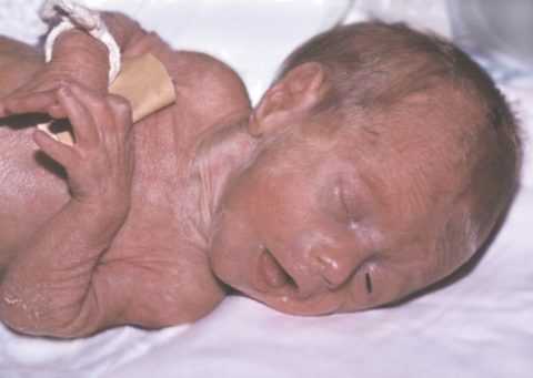 Характерный цвет кожи