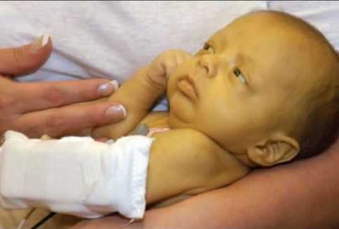 Хроническая гипергликемия. Хроническая гипергликемия.