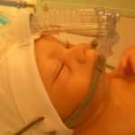 Искусственная вентиляция легких