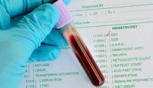 Скрытый сахарный диабет симптомы и лечение