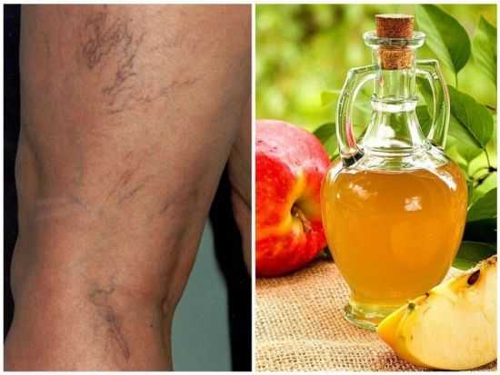 Яблоки для сосудов