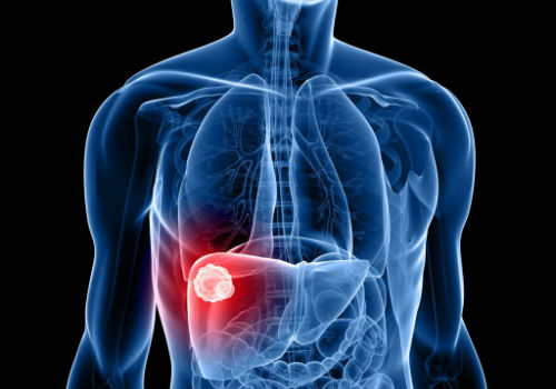 боль в печени