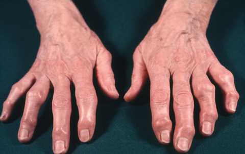 Как проявляется. Как проявляется.