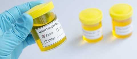 Как связан сахарный диабет с образованием ацетона в урине?