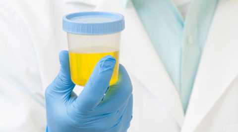 Какие методы лабораторного исследования применяются.