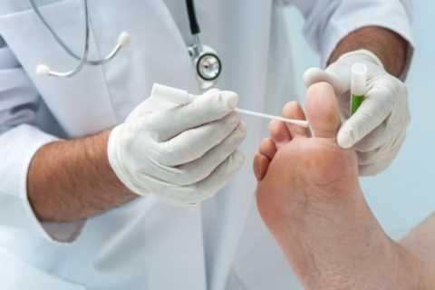 Какие препараты для местного использования можно применять при СД. Какие препараты для местного использования можно применять при СД.