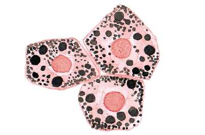 Клетки паренхимы печени (гепатоциты)