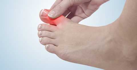 Консервативное лечение вросших ногтей доступно только на начальных стадиях патологического прогресса.