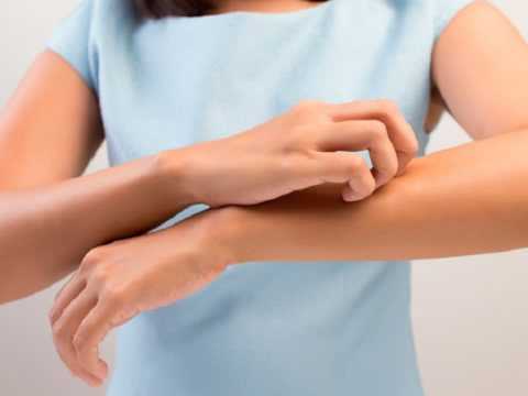 Кожный зуд при латентной форме недуга