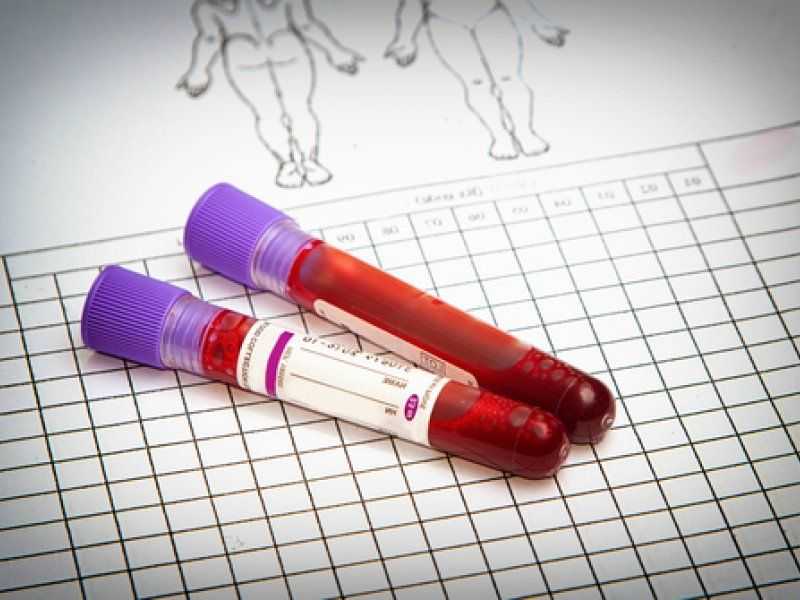 Диагностика сахарного диабета