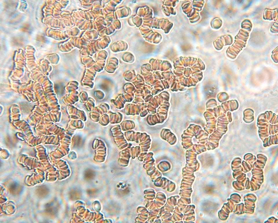 кровь под микроскопом
