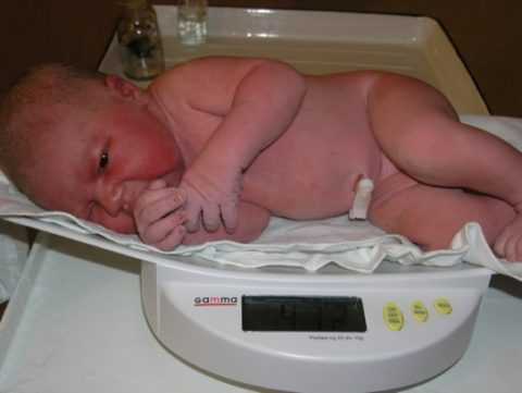 Крупные размеры плода (макросомия).