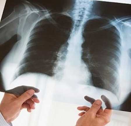 Кто находится в группе риска. Кто находится в группе риска.