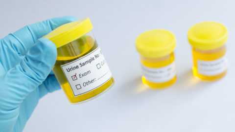 Лабораторные тесты наиболее информативны