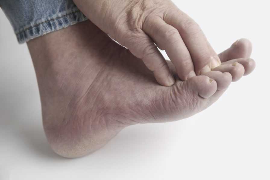 Почему нельзя использовать мази