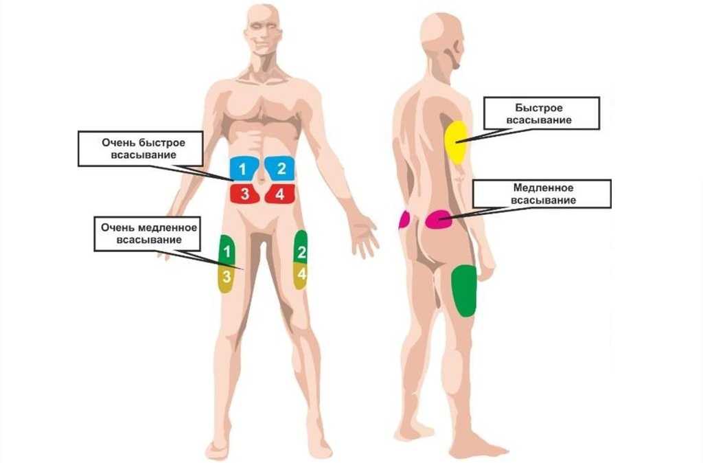 места введения инсулина